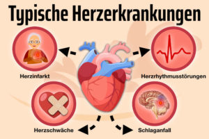 Herzkrankheiten Herz Krank Herzinfarkt Herzschwaeche