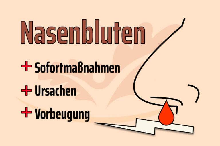Nasenbluten Was Sie dagegen tun können