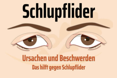 Schlupflider: Ursachen, Hausmittel und OP