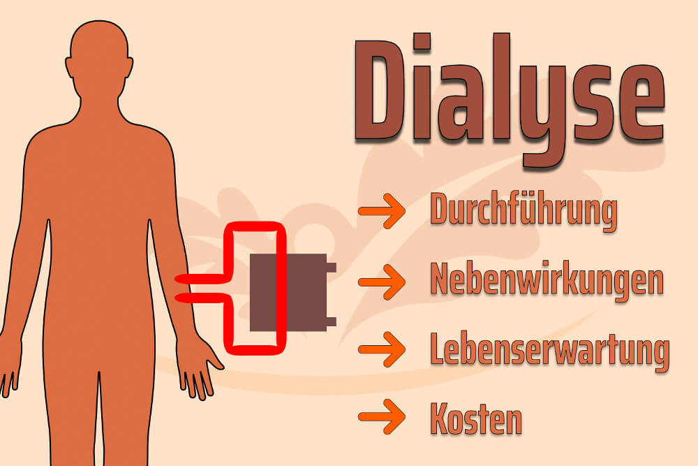 Dialyse Nierenschwaeche Nebenwirkungen Kosten Lebenserwartung